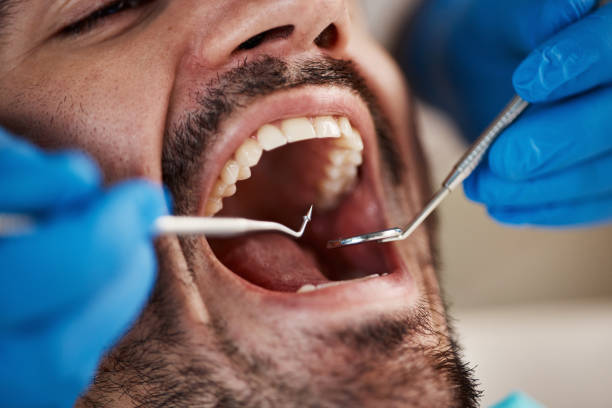 Best After-Hours Emergency Dentist in Lawrenceville, GA