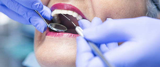 Best Emergency Wisdom Teeth Removal in Lawrenceville, GA